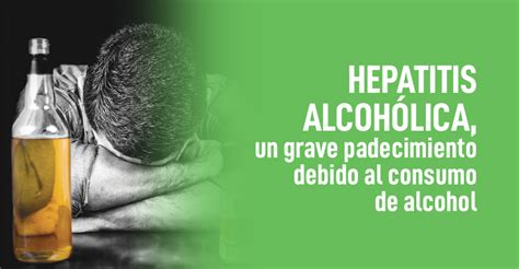 hepatitis alcohólica - hepatitis síntomas